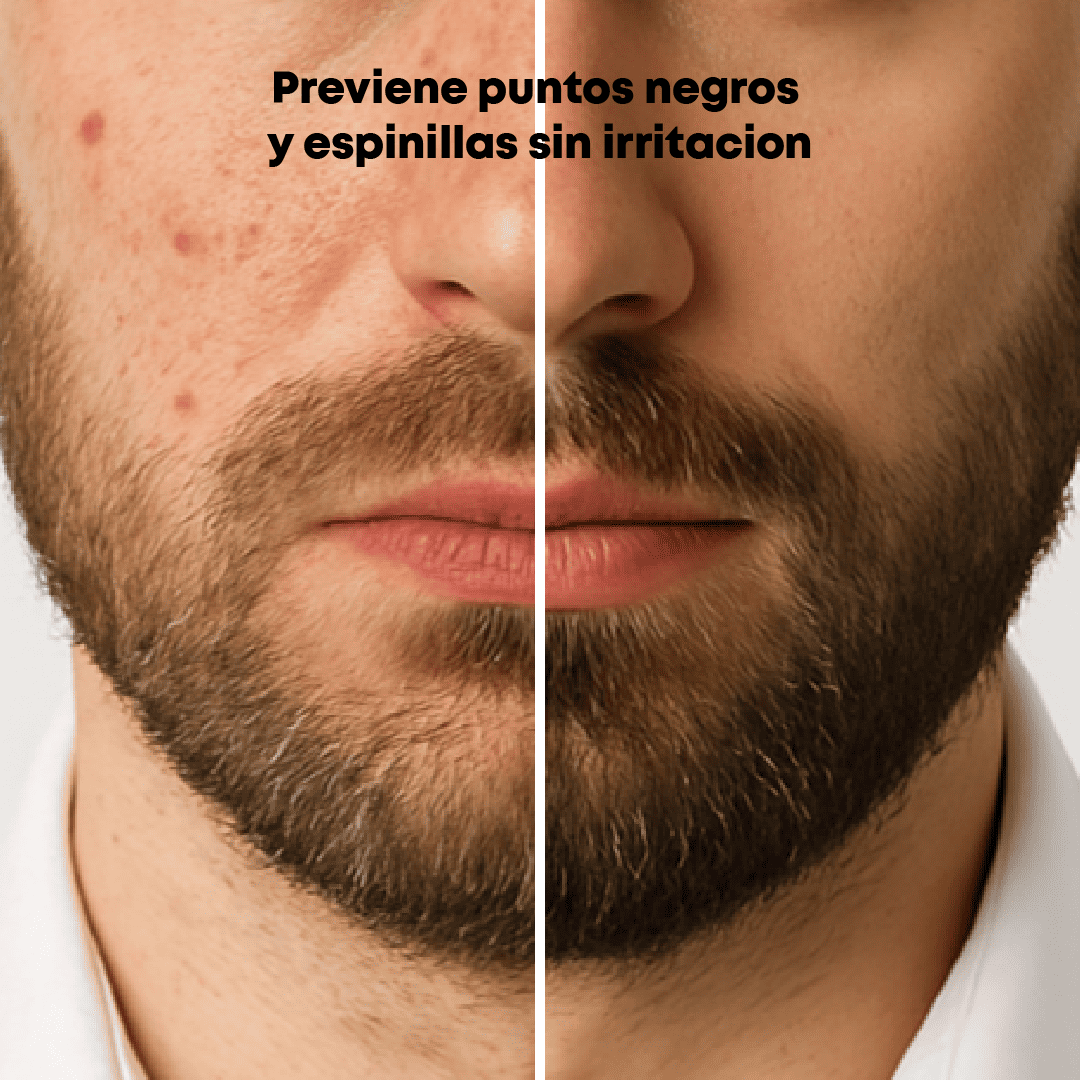 ROSTRO IMPECABLE MEN - SKIN GOLD SALICYLIC
